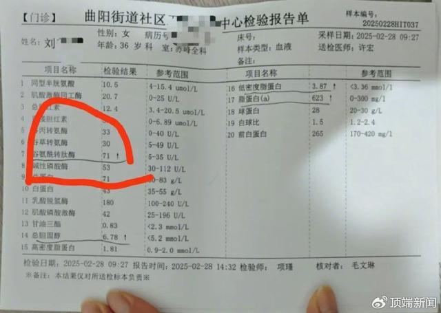 净水器水管接反女子喝5年“废水”小米：比自来水干净(图3)